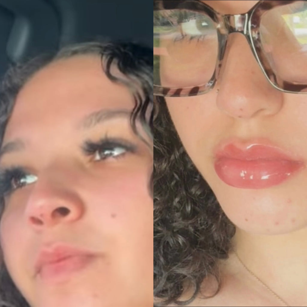 Around The Way Girl – Level 1 Lip Plumper